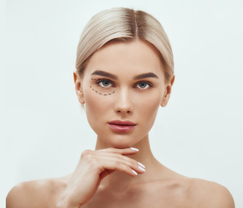 Blepharoplasty Eyelid Rejuvenation - Dr. Sharmistha Bhattacharyya