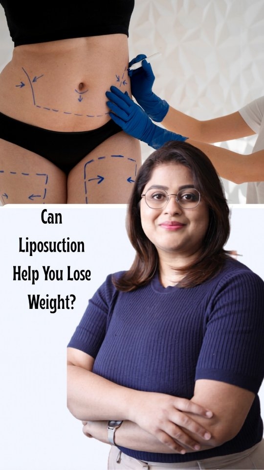 Strategic Liposuction & Anatomical Sculpting